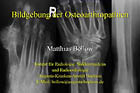 Osteoarthropathie