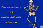 Psoriasisarthritis