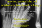 tumoroese Knochenerkrankungen