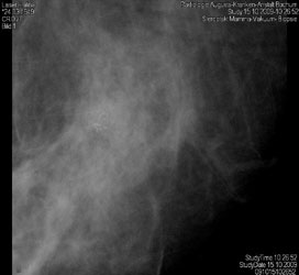 16-Zeilen-Spiral-CT