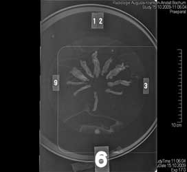 16-Zeilen-Spiral-CT